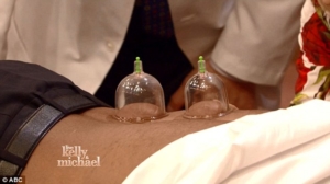 michael strahan cupping acupuncture on TV